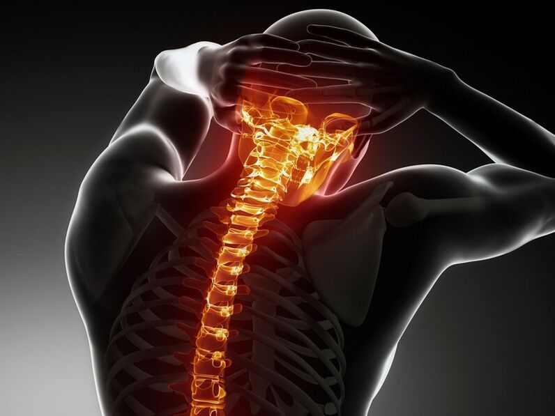 Symptomen van osteochondrose