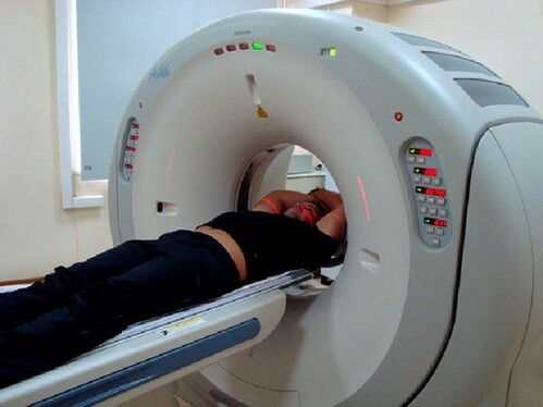 MRI-diagnostiek voor rugpijn