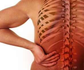 rugpijn met lumbale osteochondrose