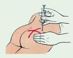 injectie voor de behandeling van osteochondrose