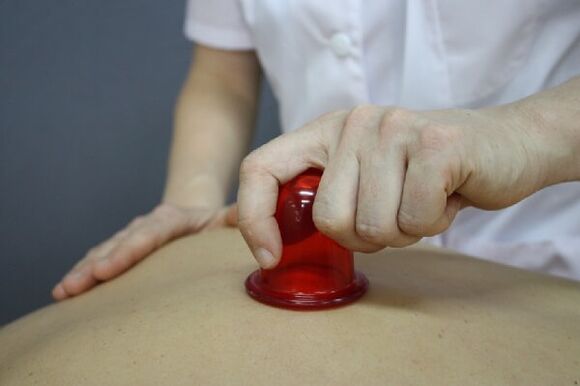 cuppingmassage voor spinale osteochondrose